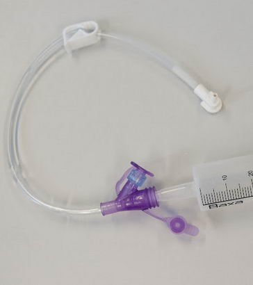 A feeding tube