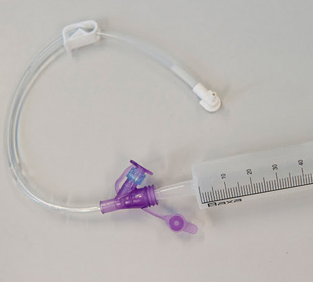 A feeding tube