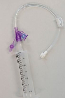 A feeding tube
