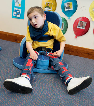 A boy sitting with leg splints