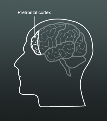 The frontal cortex of the human
                  brain.