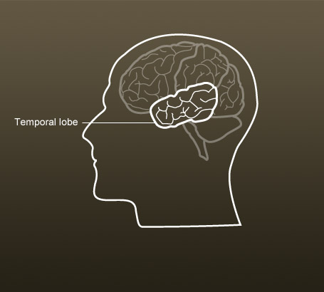 Temporal lobe