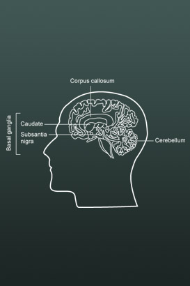 Image of the human brain.