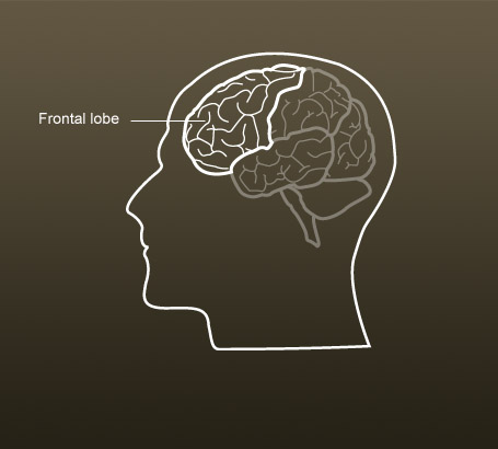 Frontal lobe